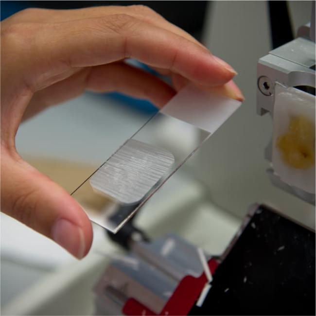 Weefseltransplantatie